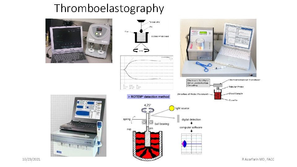 Thromboelastography 10/23/2021 13 R Azarfarin MD, FACC 