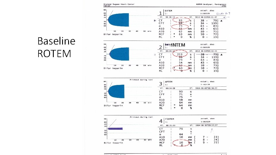 Baseline ROTEM INTEM 