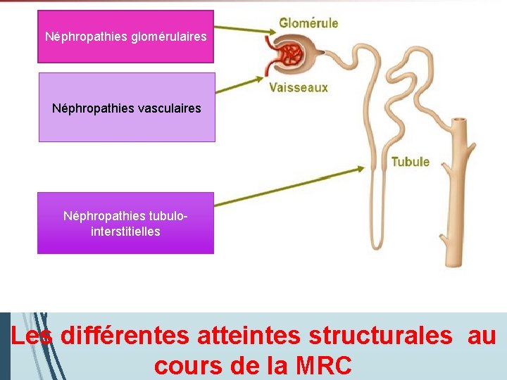 Néphropathies glomérulaires Néphropathies vasculaires Néphropathies tubulointerstitielles Les différentes atteintes structurales au cours de la