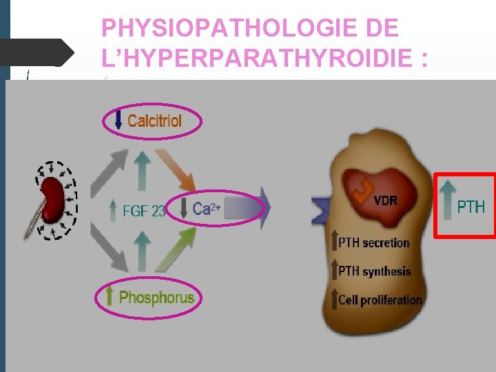 PHYSIOPATHOLOGIE DE L’HYPERPARATHYROIDIE : 