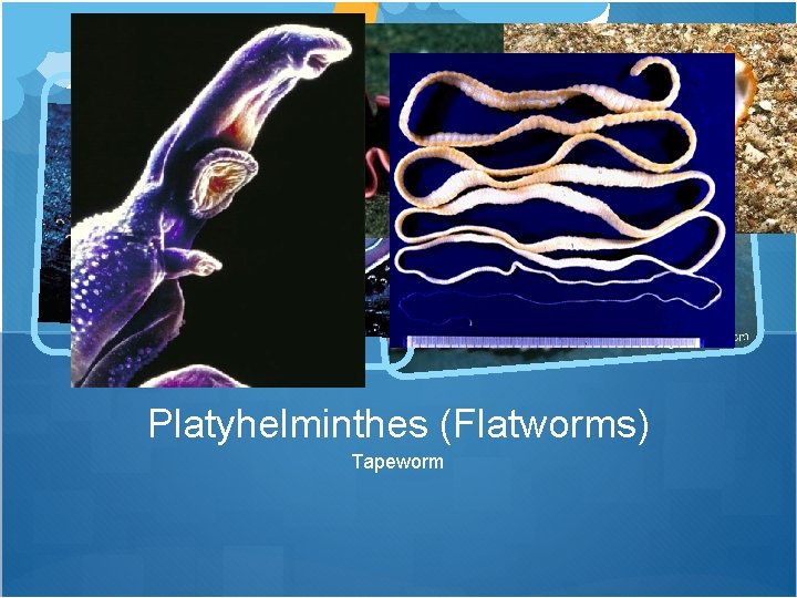 Platyhelminthes (Flatworms) Tapeworm 