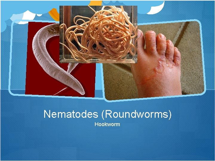 Nematodes (Roundworms) Hookworm 