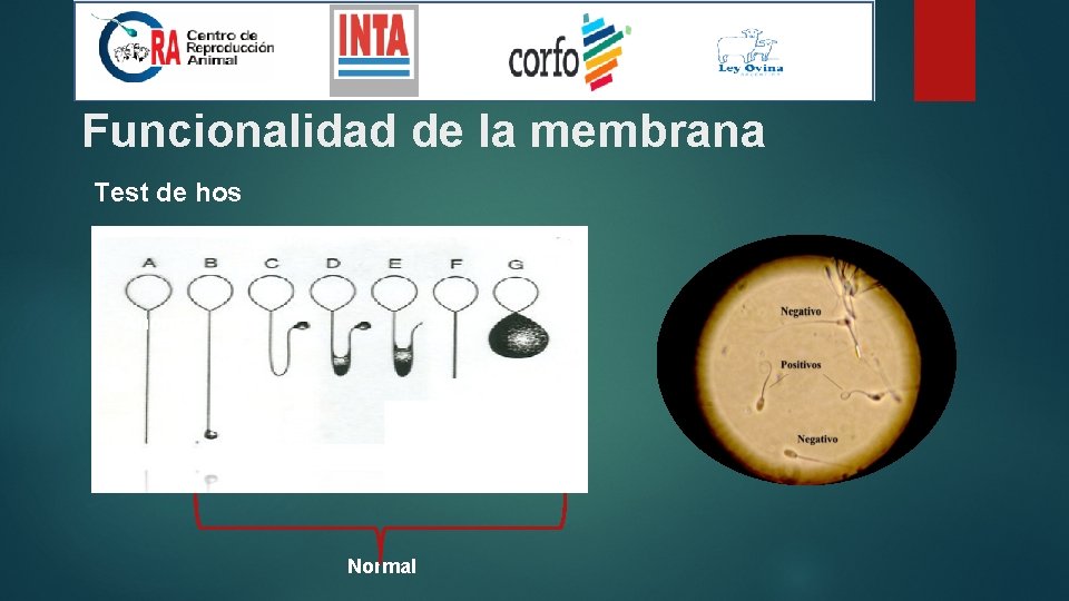 Funcionalidad de la membrana Test de hos Anormal Normal 