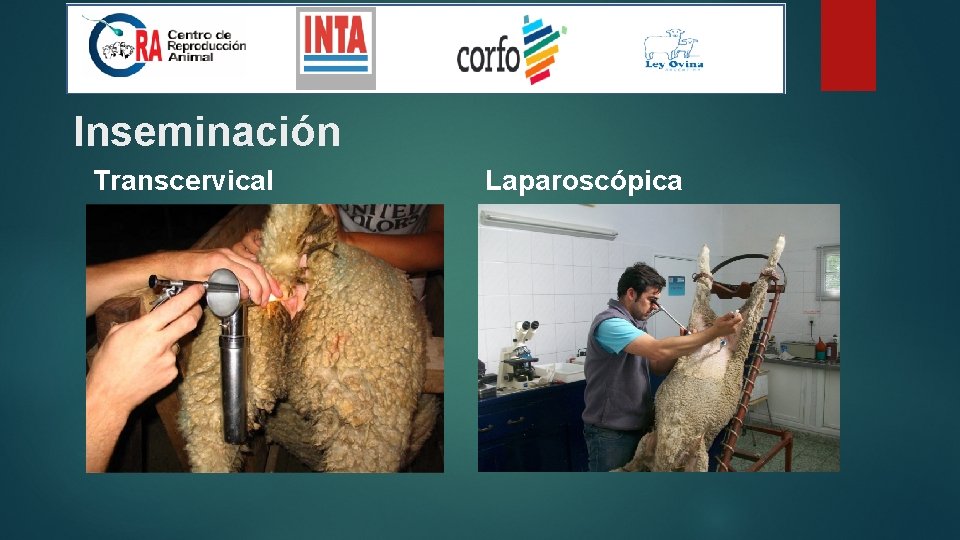 Inseminación Transcervical Laparoscópica 