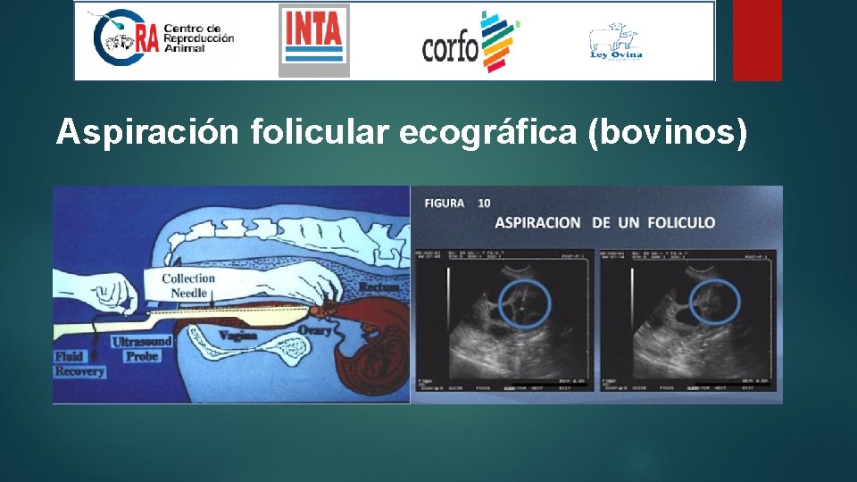 Aspiración folicular ecográfica (bovinos) 