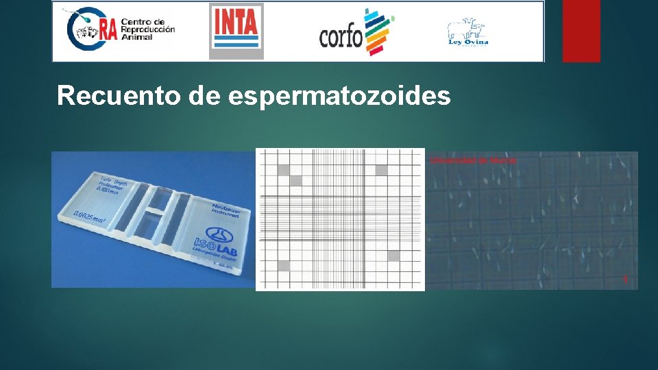 Recuento de espermatozoides 