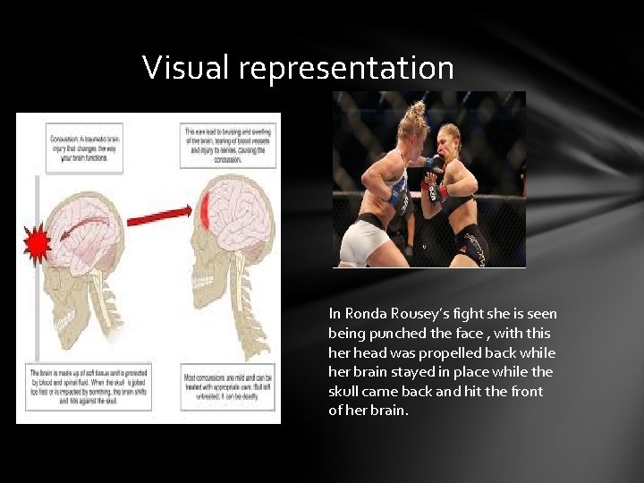 Visual representation In Ronda Rousey’s fight she is seen being punched the face ,