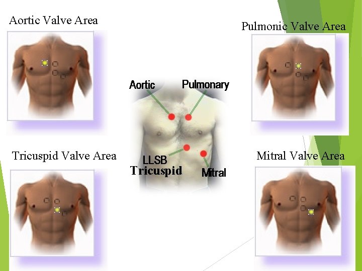 Aortic Valve Area Pulmonic Valve Area Tricuspid Valve Area Mitral Valve Area Tricuspid 18