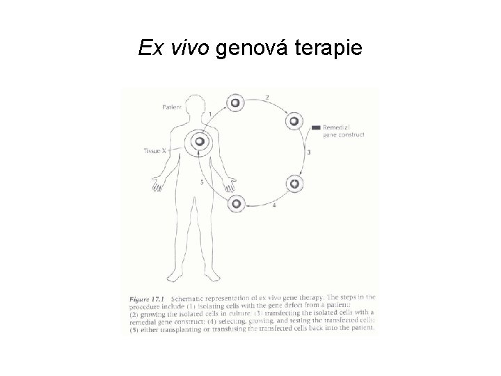 Ex vivo genová terapie 