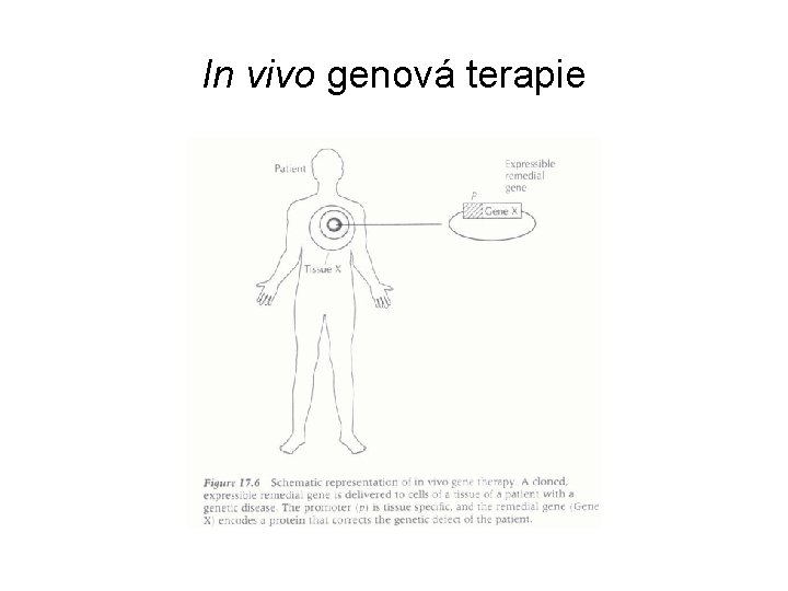 In vivo genová terapie 