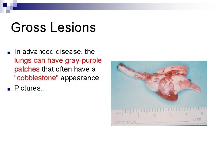 Gross Lesions ■ ■ In advanced disease, the lungs can have gray-purple patches that