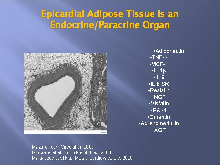 Epicardial Adipose Tissue is an Endocrine/Paracrine Organ • Adiponectin • TNF- • MCP-1 •