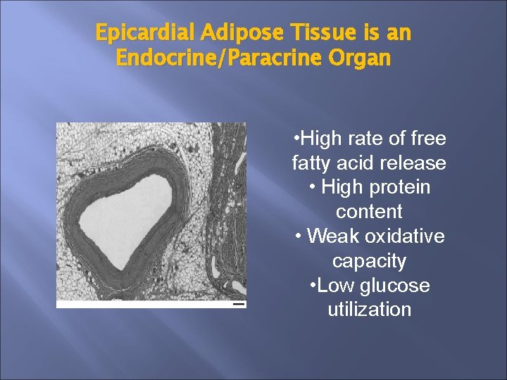 Epicardial Adipose Tissue is an Endocrine/Paracrine Organ • High rate of free fatty acid