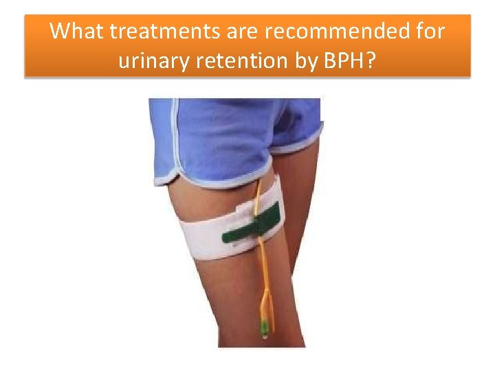 What treatments are recommended for urinary retention by BPH? 