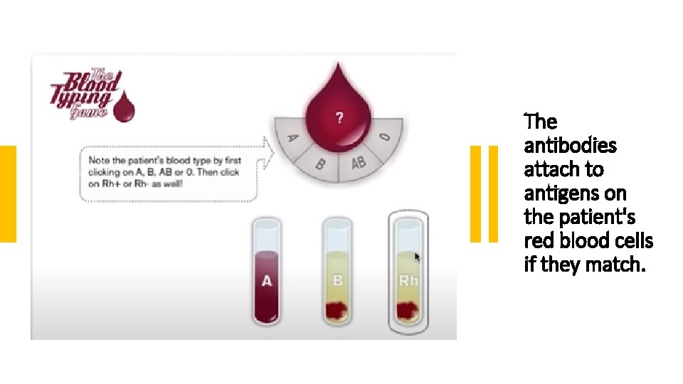 The antibodies attach to antigens on the patient's red blood cells if they match.