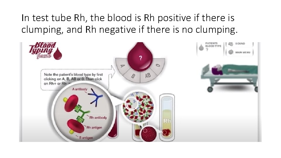 In test tube Rh, the blood is Rh positive if there is clumping, and