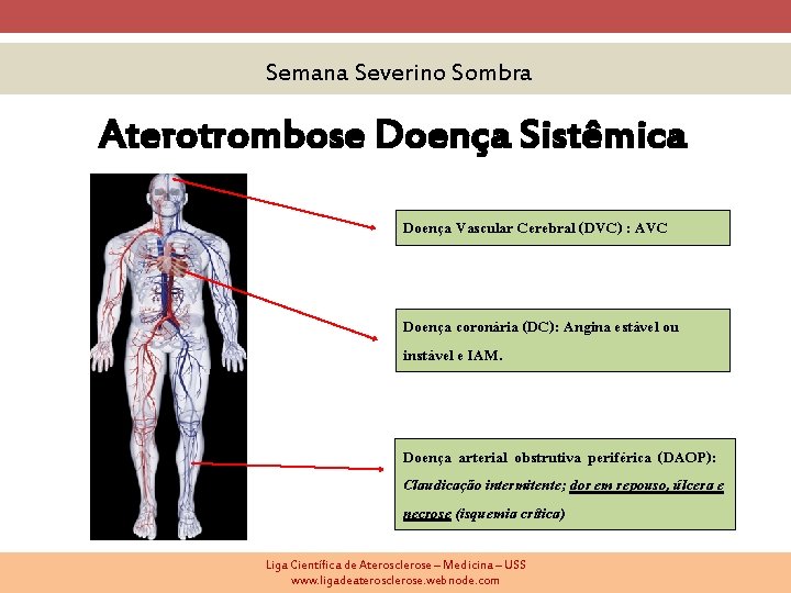 Semana Severino Sombra Aterotrombose Doença Sistêmica Doença Vascular Cerebral (DVC) : AVC Doença coronária