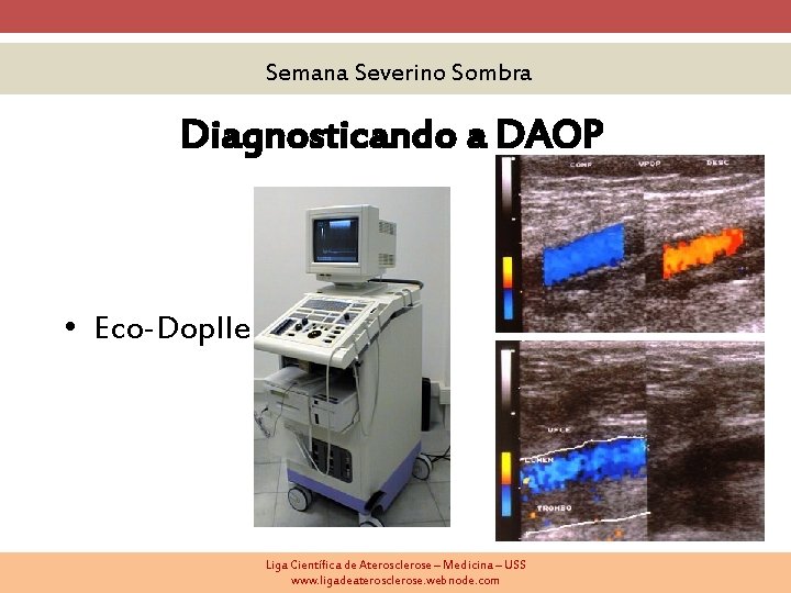 Semana Severino Sombra Diagnosticando a DAOP • Eco-Dopller Liga Científica de Aterosclerose – Medicina