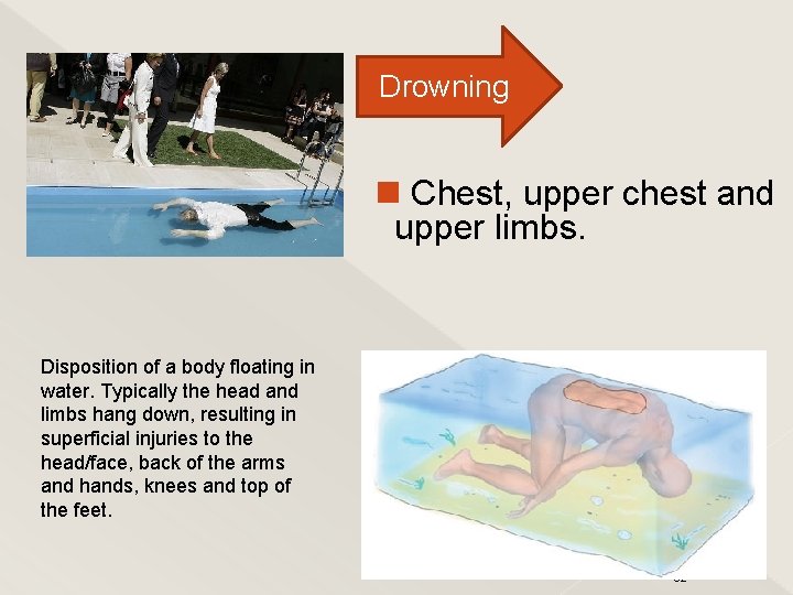 Drowning Chest, upper chest and upper limbs. Disposition of a body floating in water.