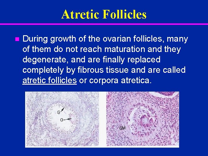 Atretic Follicles n During growth of the ovarian follicles, many of them do not