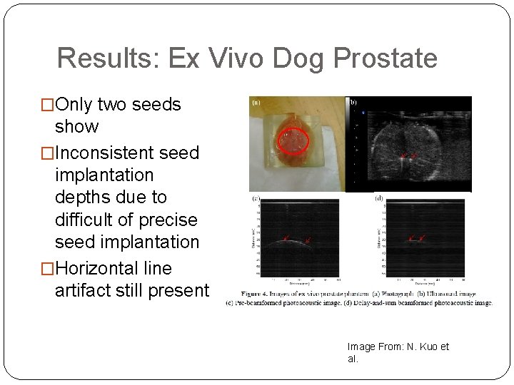 Results: Ex Vivo Dog Prostate �Only two seeds show �Inconsistent seed implantation depths due