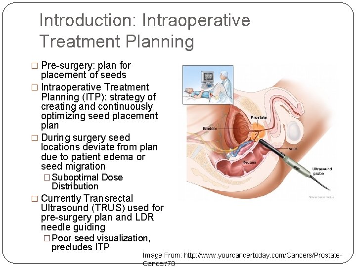 Introduction: Intraoperative Treatment Planning � Pre-surgery: plan for placement of seeds � Intraoperative Treatment