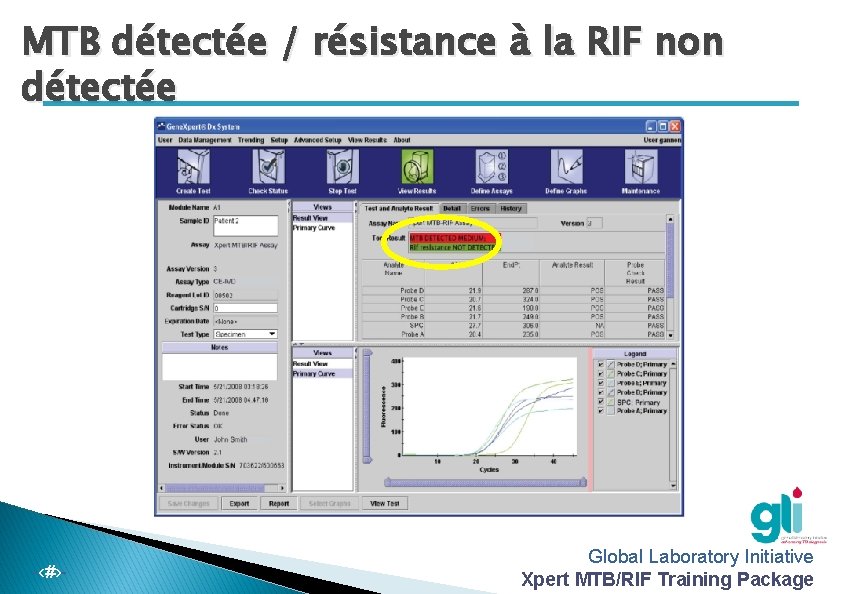 MTB détectée / résistance à la RIF non détectée -‹#›- Global Laboratory Initiative Xpert