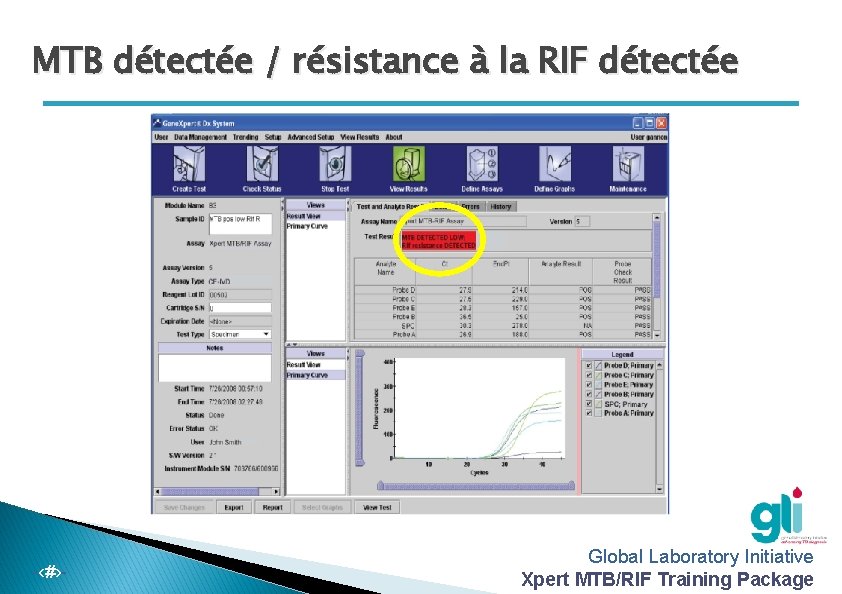MTB détectée / résistance à la RIF détectée -‹#›- Global Laboratory Initiative Xpert MTB/RIF