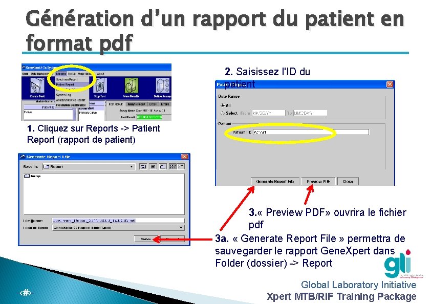 Génération d’un rapport du patient en format pdf 2. Saisissez l'ID du patient 1.