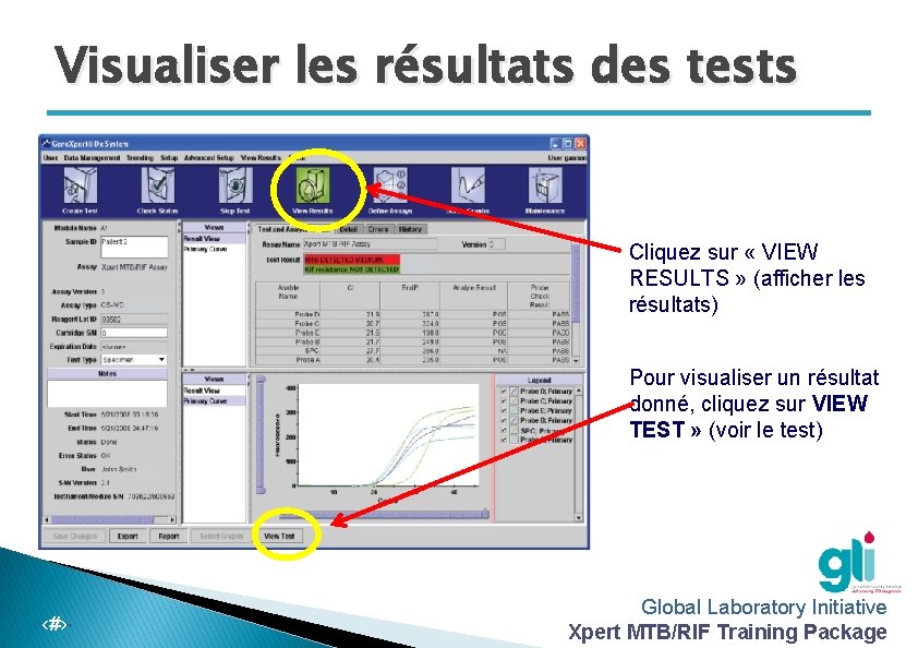 Visualiser les résultats des tests Cliquez sur « VIEW RESULTS » (afficher les résultats)