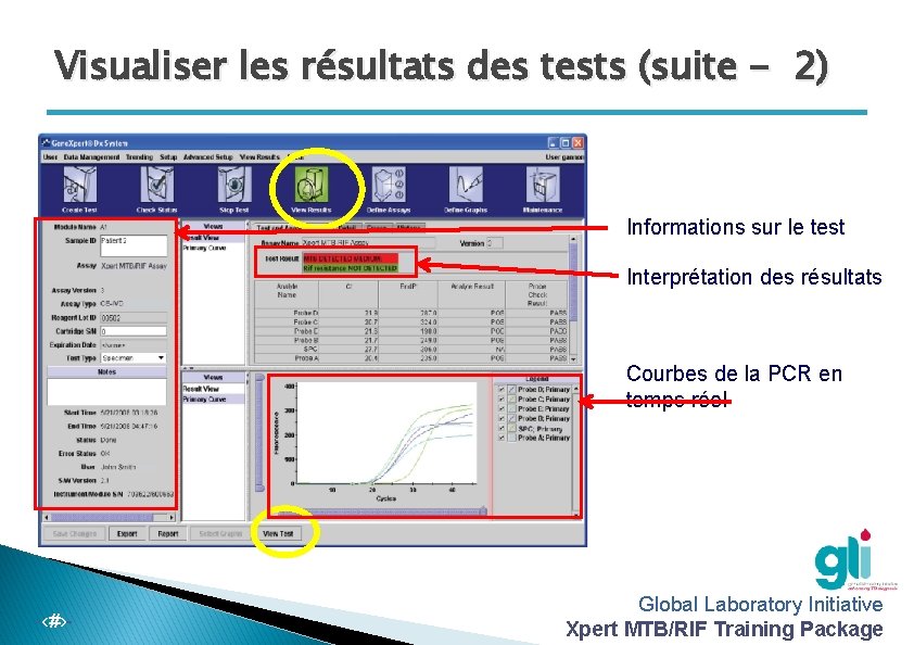 Visualiser les résultats des tests (suite - 2) Informations sur le test Interprétation des