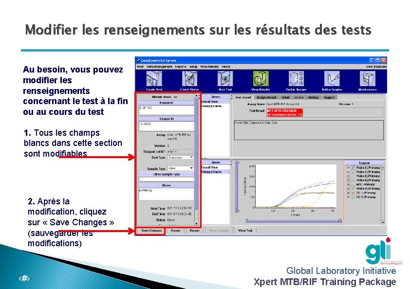 Modifier les renseignements sur les résultats des tests Au besoin, vous pouvez modifier les