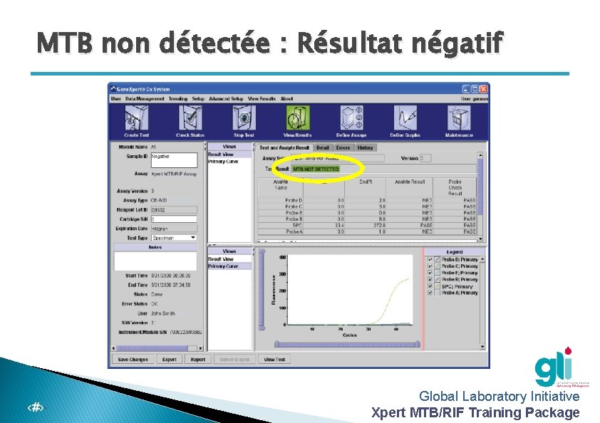 MTB non détectée : Résultat négatif -‹#›- Global Laboratory Initiative Xpert MTB/RIF Training Package
