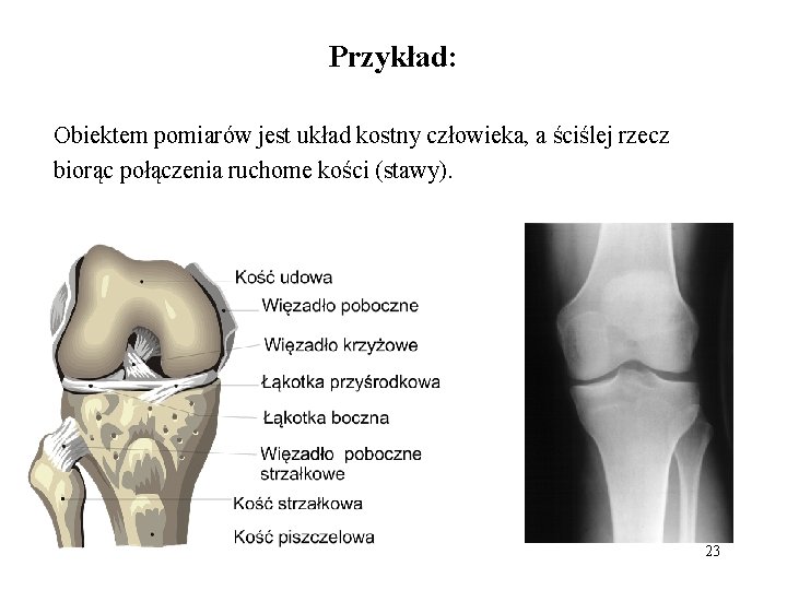 Przykład: Obiektem pomiarów jest układ kostny człowieka, a ściślej rzecz biorąc połączenia ruchome kości