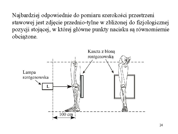 Najbardziej odpowiednie do pomiaru szerokości przestrzeni stawowej jest zdjęcie przednio-tylne w zbliżonej do fizjologicznej