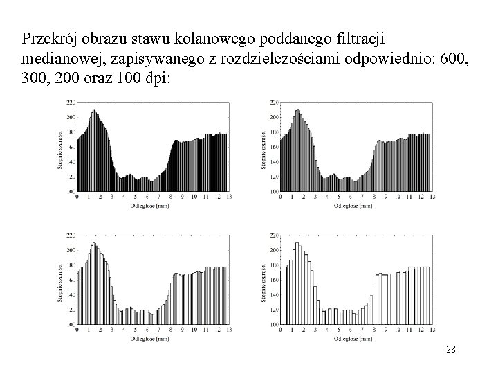 Przekrój obrazu stawu kolanowego poddanego filtracji medianowej, zapisywanego z rozdzielczościami odpowiednio: 600, 300, 200