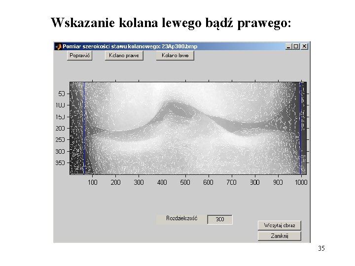 Wskazanie kolana lewego bądź prawego: 35 