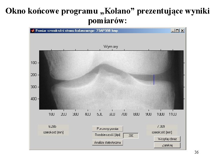 Okno końcowe programu „Kolano” prezentujące wyniki pomiarów: 36 