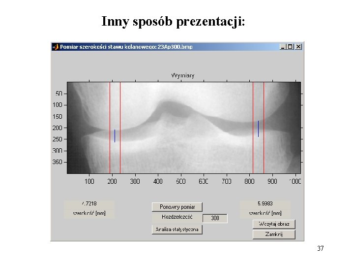 Inny sposób prezentacji: 37 