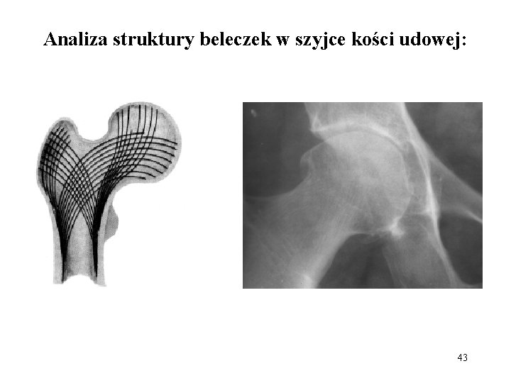 Analiza struktury beleczek w szyjce kości udowej: 43 