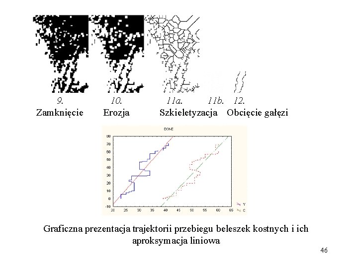 9. Zamknięcie 10. Erozja 11 a. 11 b. 12. Szkieletyzacja Obcięcie gałęzi Graficzna prezentacja