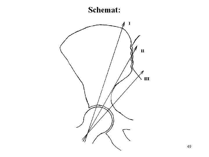 Schemat: 49 