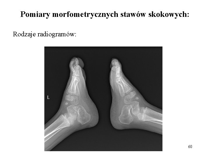 Pomiary morfometrycznych stawów skokowych: Rodzaje radiogramów: 60 