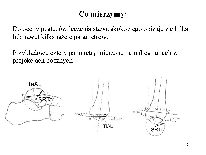 Co mierzymy: Do oceny postępów leczenia stawu skokowego opisuje się kilka lub nawet kilkanaście