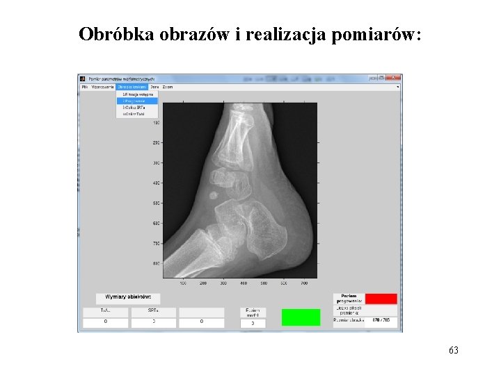 Obróbka obrazów i realizacja pomiarów: 63 