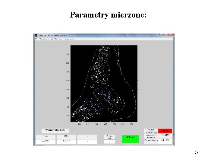 Parametry mierzone: 67 