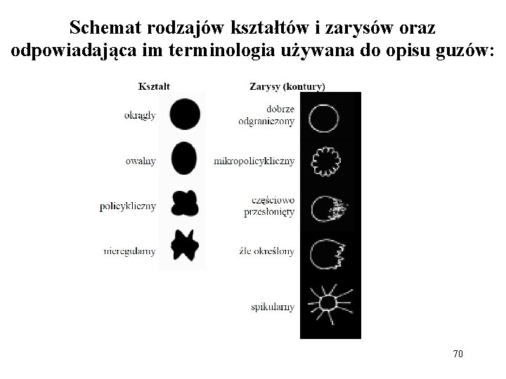 Schemat rodzajów kształtów i zarysów oraz odpowiadająca im terminologia używana do opisu guzów: 70