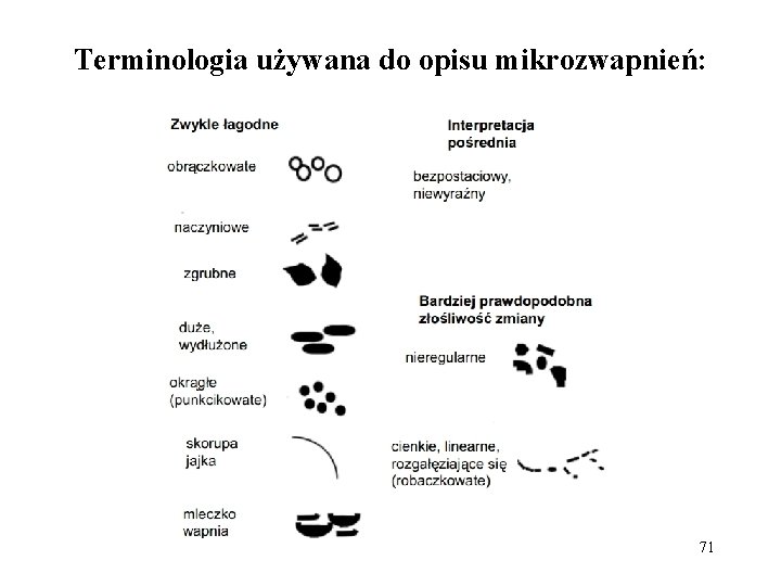 Terminologia używana do opisu mikrozwapnień: 71 