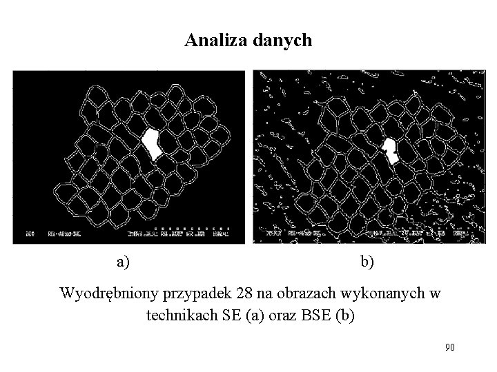 Analiza danych a) b) Wyodrębniony przypadek 28 na obrazach wykonanych w technikach SE (a)