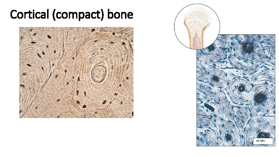 Cortical (compact) bone LM 160 x 